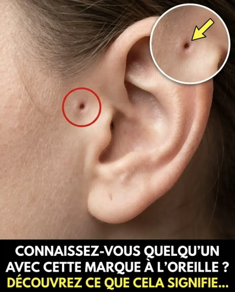Decouvrez la signification de cette marque sur loreille.jpg (1)