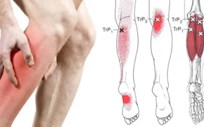 Dolore alle gambe