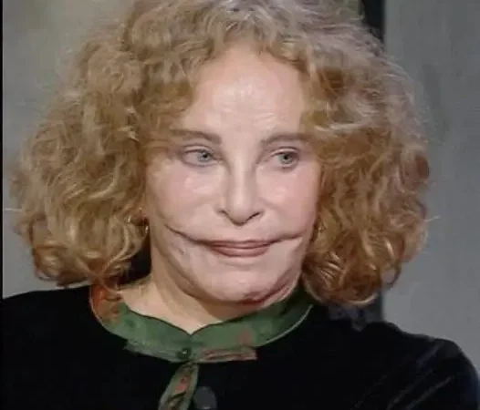 Sydne Rome, star oubliée des années 70 : l’accident qui a changé son visage et la force avec laquelle elle s’est reconstruite