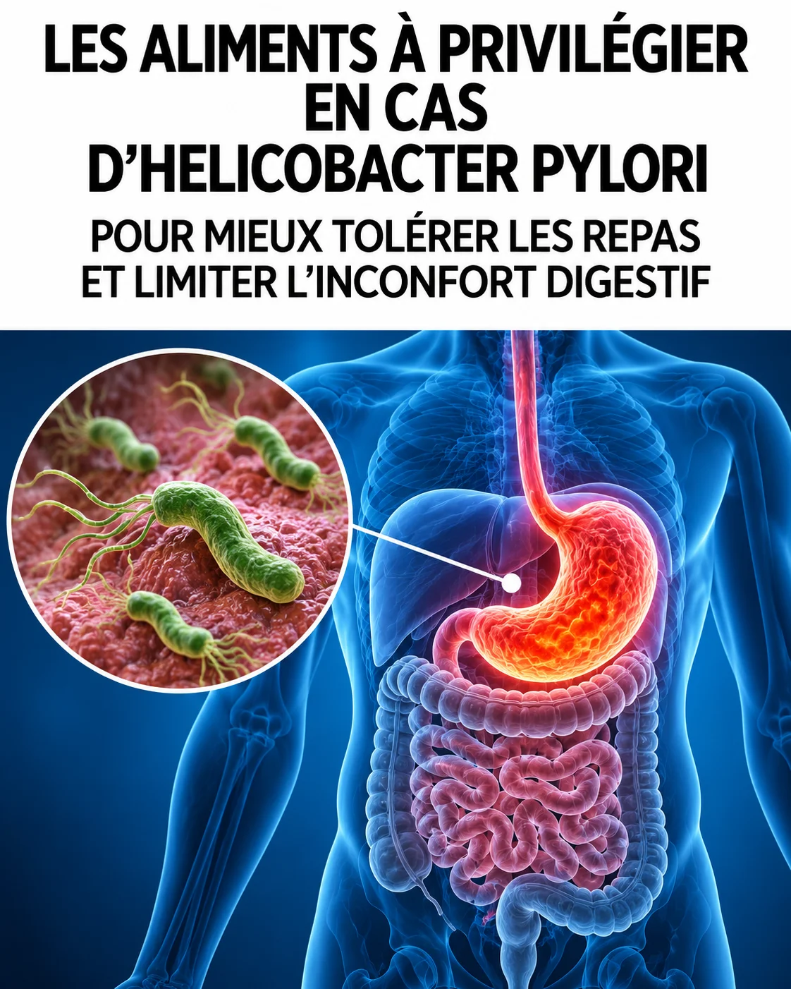 Aliments à privilégier contre Helicobacter pylori